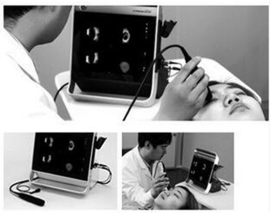 SW-2000眼科A/B超声诊断仪