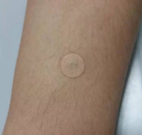 01Y；02Y远红外揿针