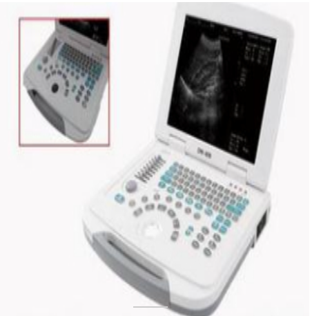 DW-500笔记本全数字超声诊断仪