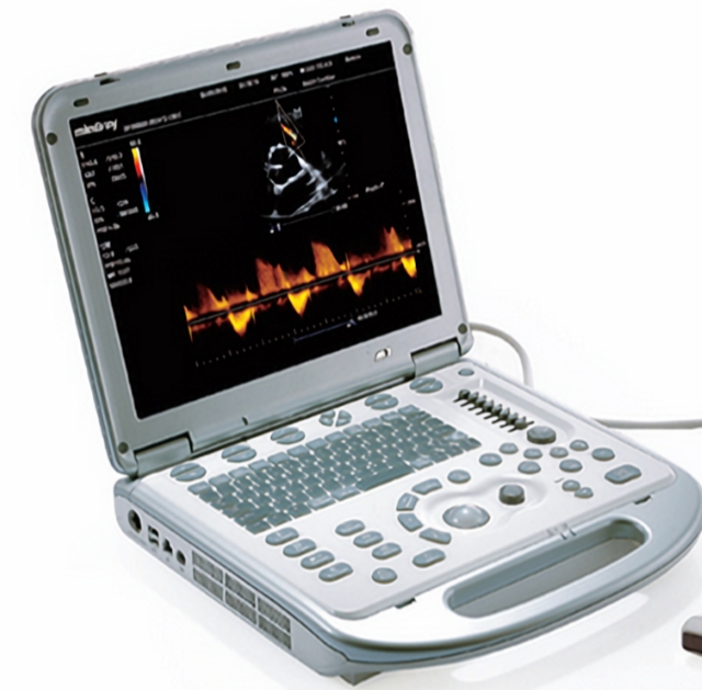 TINGSN FINDERS 1便携式彩色超声诊断仪