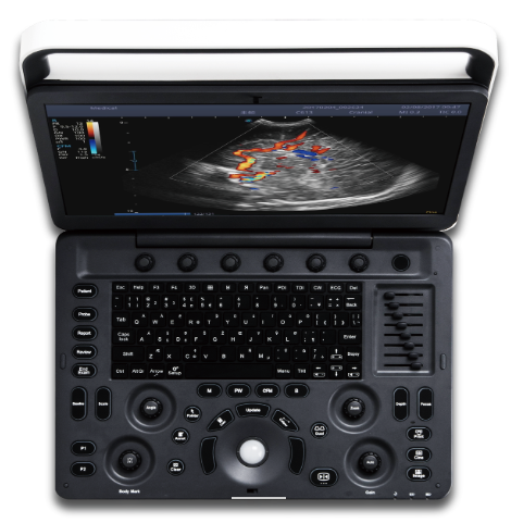 X3 Pro便携式彩色多普勒超声诊断系统