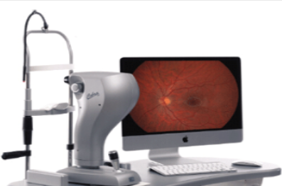 Fundus camera眼底照相机