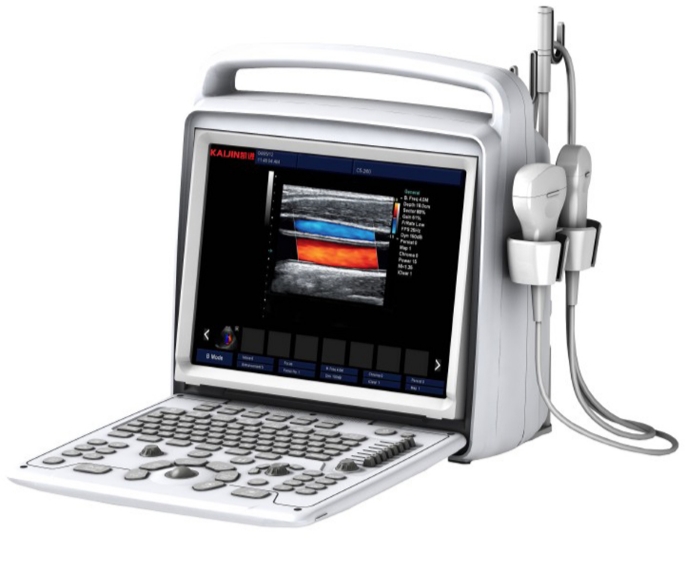 EPIQ CVx Plus彩色超声诊断系统
