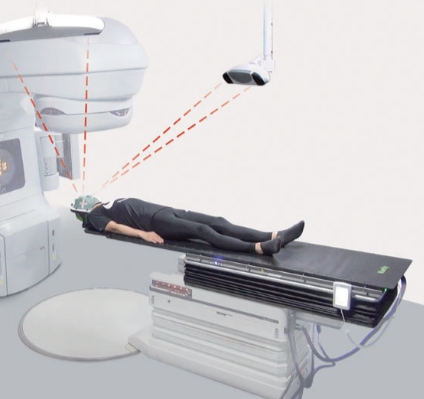 Sentinel放射治疗患者光学定位系统