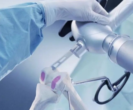 膝关节手术工具 Knee Joint Instruments