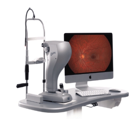 眼底照相机Fundus camera