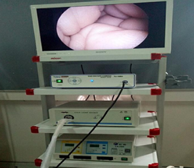 KY-688-SD内窥镜摄像系统