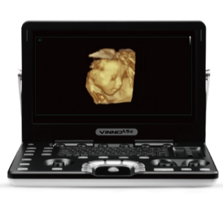 VINNO Q3＋3C掌上彩色超声诊断仪