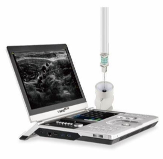VINNO Q5＋2P掌上彩色超声诊断仪