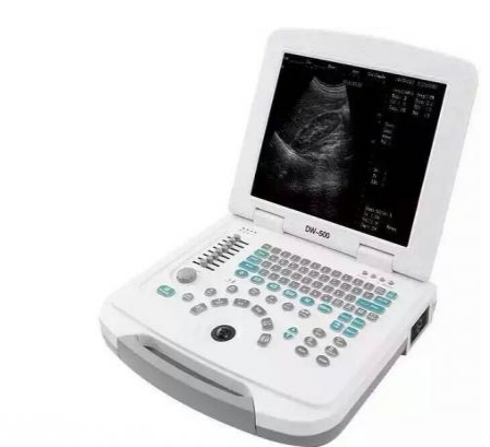dw-580笔记本式全数字超声诊断仪 