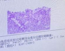 HM-LD一次性使用肺外科标记物