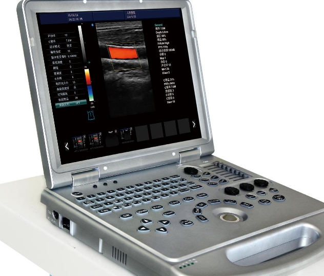 SonoEye G1WS-G 全数字掌上彩色多普勒超声诊断仪祥生维修