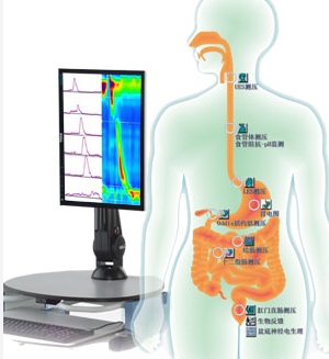 Solar GI 荷兰MMS胃肠动力学检查系统