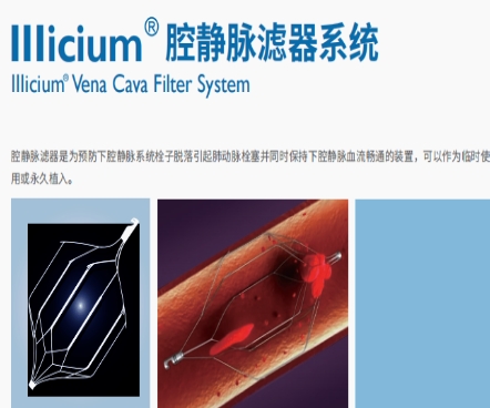 wxf-32 威海维心腔静脉滤器系统
