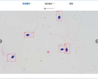 SpermShapeAnalysis V1 朴华精子形态分析软件