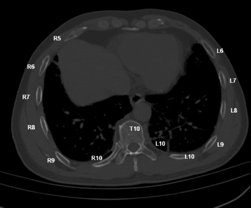 uIGS Spine 200 脊柱医学影像处理软件