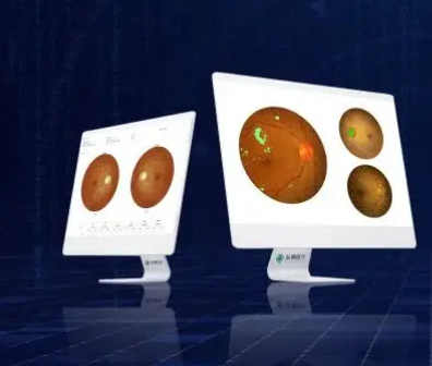 SYSEYE 眼科医学影像存储与传输系统贝奥新视野