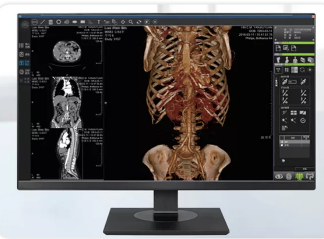 PMT 3D 1.0 三维医学影像处理软件普能