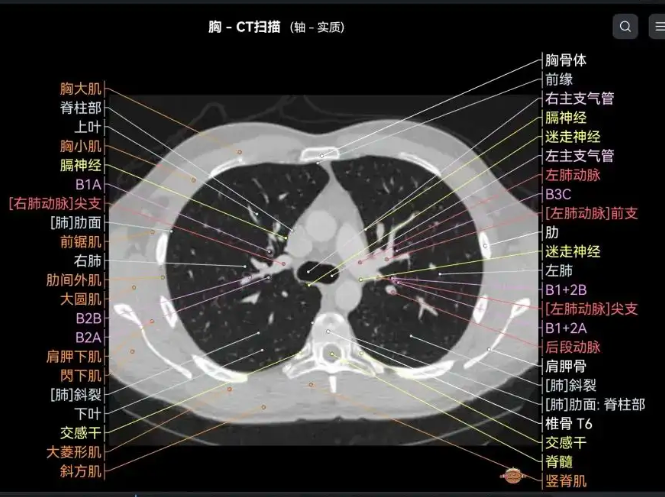 JF-XC-1 胸部医学影像处理软件