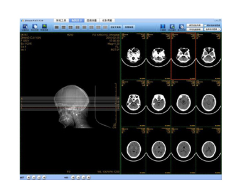 HY-MRI-PANCREAS 胰腺MRI医学影像存储传输与处理软件