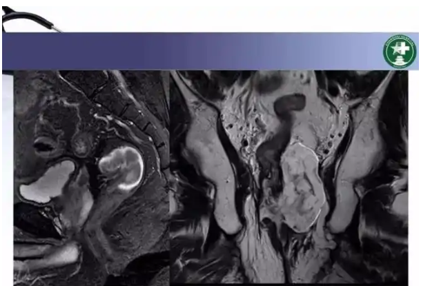 HY-MRI-CRADS 直肠MRI医学影像存储传输与处理软件