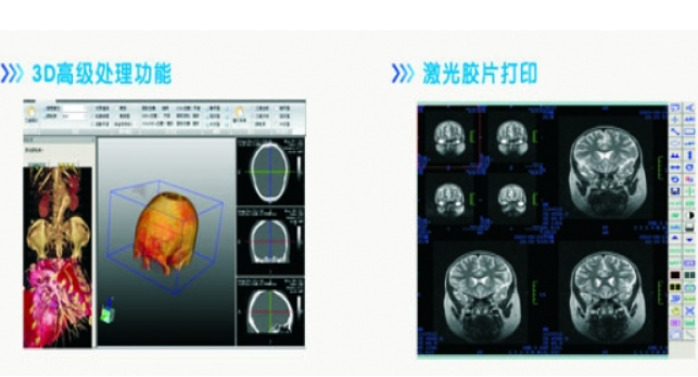 SILVER-PACS4.8 医学影像系统