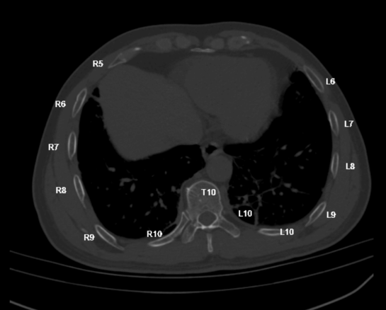 Artery3DPlus 冠状动脉和脑颈动脉医学影像处理软件