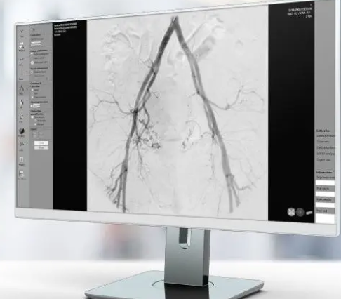 3mensio Workstation 心血管图像处理软件