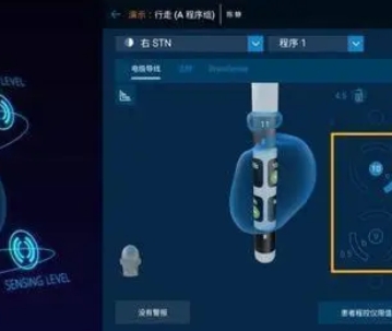 SenSight 美敦力植入式脑深部刺激电极