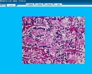 dInsight CD免疫组化病理图像分析软件迪英加