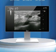 AiriScan T6产前动态超声影像处理系统爱孕记
