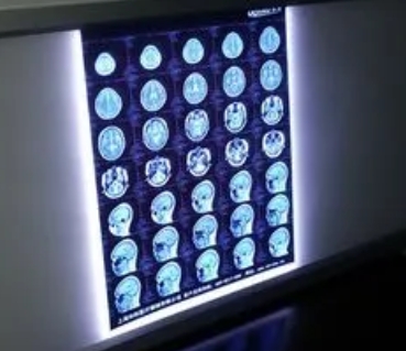 AD8210 中兴佳业医用观片灯
