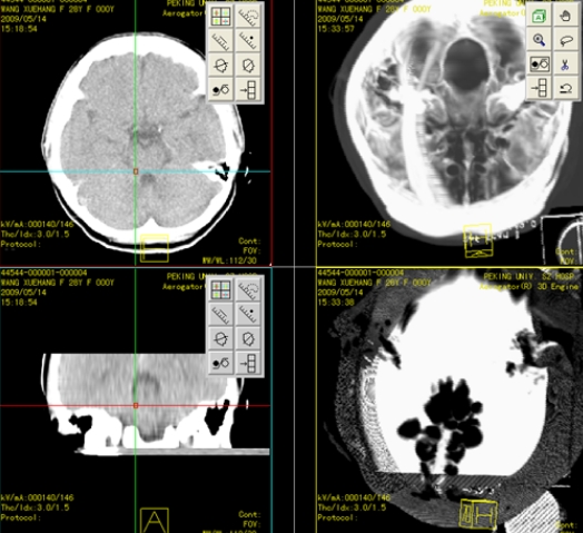 WRMT Eye Viewer医学影像存储与传输系统软件唯智