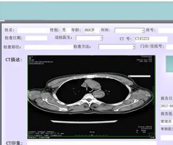 RLMI-PACS医学影像存储与传输系统软件智远汇壹