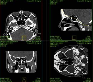 MY-PACS-03医学影像存储与传输系统软件