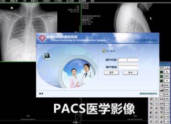 F-PACS医学影像存储与传输系统软件丰泽瑞