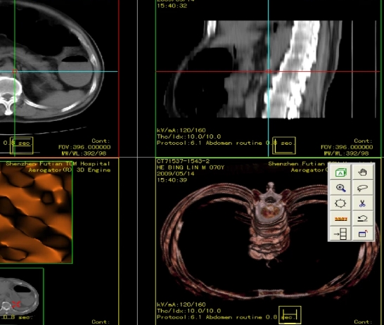 BN-PACS-3001医学影像存储与传输系统软件倍宁
