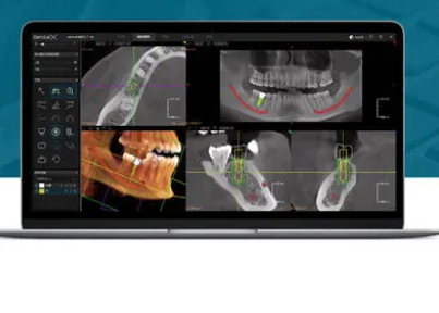 CS Imaging 牙科影像处理软件
