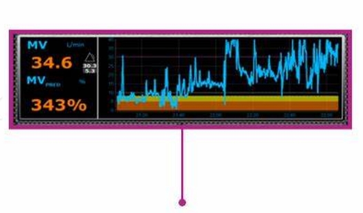 OHM-DPI-100 呼吸功能数据监测分析软件橙心