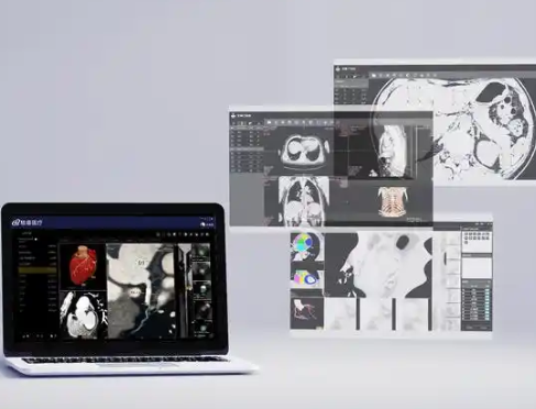 GD-PACS V 4.0_Ⅰ 医学影像数据传输处理软件