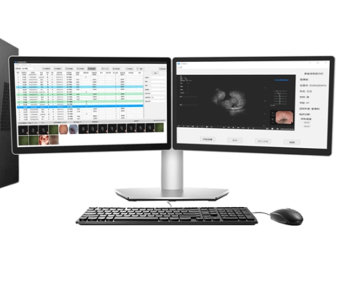 DBB001 医学影像管理软件