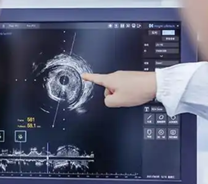 InTo IVUS 血管内超声影像处理软件