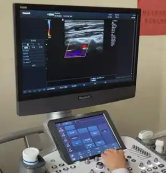 PLUS S300 妇产超声影像工作站