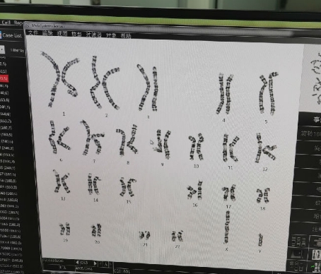 MS-I-I 染色体核型分析软件科莫