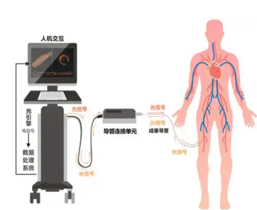 Cornaris Mobile+ 心血管光学相干影像系统