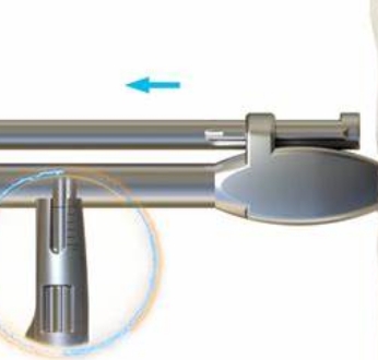 自稳定型颈椎融合器朔崛