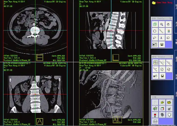 Artery3D 动脉医学影像三维重建处理软件