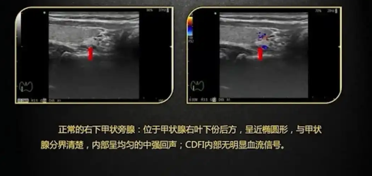 XBSJ-02-1.0.0 甲状腺医学影像存储与传输系统软件