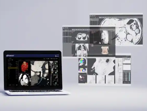 3Dspine 脊椎CT影像处理软件