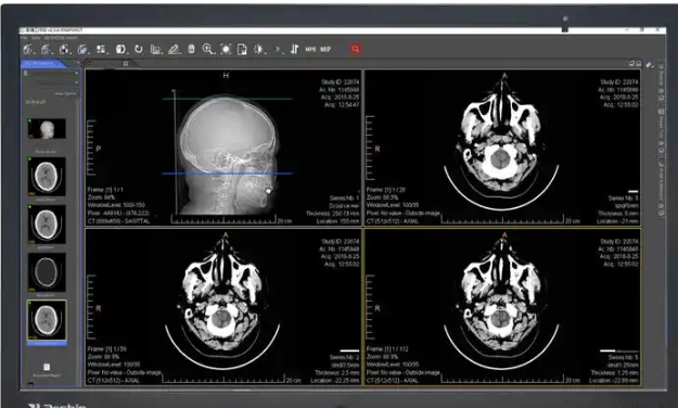 uAI-JointImaging-MRI 骨关节磁共振影像处理软件